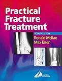 Practical Fracture Treatment