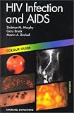 HIV Infection and Aids: Colour Guide (Colour Guides)