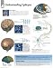 Understanding Epilepsy