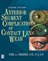 Anterior Segment Complications of Contact Lens Wear, 2e