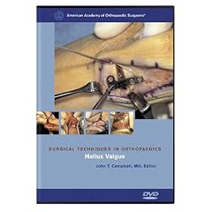 Sto Hallux Valgus by John T. Campbell