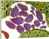 Box Canvas Print of Toxoplasmosis from Science Photo Library