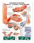 Understanding Carpal Tunnel Syndrome Anatomical Chart Laminated