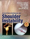 Controversies in shoulder instability