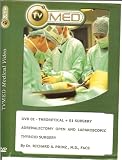 Thyroid and Parathyroidectomy -Surgery Update by Richard A. Prinz, MD, FACS - DVD 1- Adrenalectomy: Open and Laparoscopic