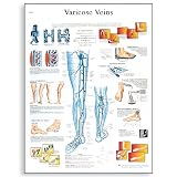 3B Scientific VR1367UU Glossy Paper Varicose Veins Anatomical Chart, Poster Size 20" Width x 26" Height