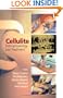 Cellulite: Pathophysiology and Treatment (Basic and Clinical Dermatology)