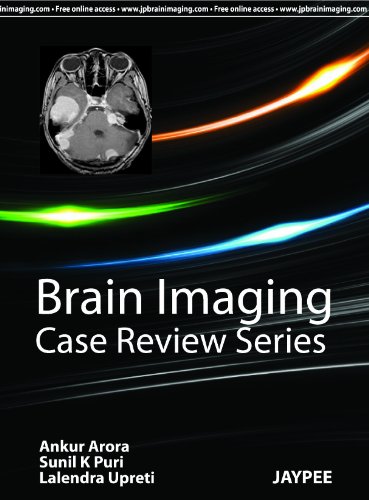 Brain Imaging (Case Review)