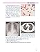 Respiratory Medicine: Self-Assessment Colour Review, Third Edition (Medical Self-Assessment Color Review Series)