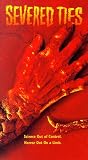Severed Ties Severed Ties