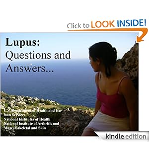 Causes Lupus 5