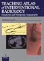 Teaching Atlas of Interventional Radiology: Diagnostic and Therapeutic Angiography