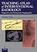 Teaching Atlas of Interventional Radiology: Diagnostic and Therapeutic Angiography