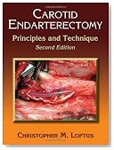 Carotid Endarterectomy: Principles and Technique, Second Edition