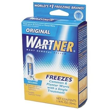 plantar warts removal