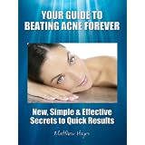 Your Guide to Beating Acne Forever - New, Simple & Effective Secrets to Quick Results