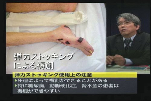 Cover image : 褥創治療最前線！Dr.鳥谷部の超ラップ療法 ケアネットDVD