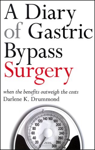 gastric bypass surgery