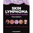 Skin Lymphoma: The Illustrated Guide