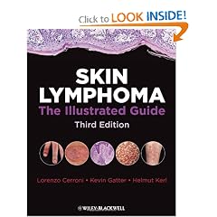 Skin Lymphoma: The Illustrated Guide by Lorenzo Cerroni, Kevin Gatter and Kerl Helmut
