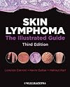 Skin Lymphoma: The Illustrated Guide