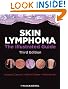 Skin Lymphoma: The Illustrated Guide