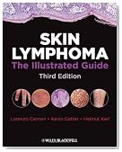 Skin Lymphoma: The Illustrated Guide
