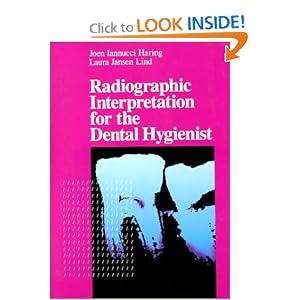 Click here to buy Radiographic Interpretation for the Dental Hygienist by Joen Iannucci DDS MS and Laura Jansen Lind RDH MS.
