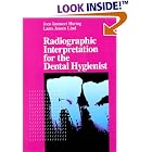 Radiographic Interpretation for the Dental Hygienist by  Joen Iannucci and Laura Jansen Lind