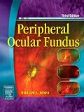 Peripheral Ocular Fundus