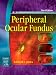 Book Peripheral Ocular Fundus