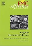 Imagerie des tumeurs du foie