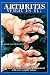 Book Arthritis What Is It?: Decades of Diagnosis and Management with an Exciting Future