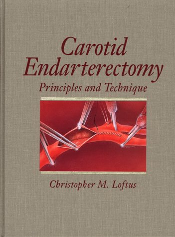 Carotid-Endarterectomy