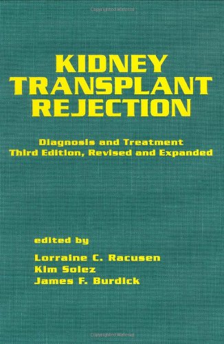 Kidney Transplant Rejection: Diagnosis and Treatment, Third Edition