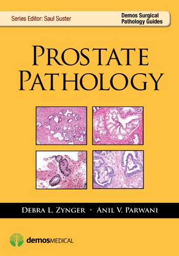 Prostate Pathology (Demos Surgical Pathology Guides)