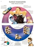 Anatomische Lehrtafel: Lesioni traumatiche della colonna cervicale