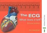 The ECG - What does it tell? 2nd Edition