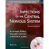 infections of the central nervous system