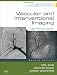 Vascular and Interventional Imaging: Case Review Series