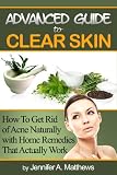 Advanced Guide to Clear Skin: How To Get Rid of Acne Naturally with Home Remedies That Actually Work 51TO2F9YKlL. SL160 Advanced Guide to Clear Skin: How To Get Rid of Acne Naturally with Home Remedies That Actually Work