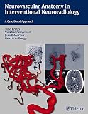 Comprehensive management of arteriovenous malformation of the brain and spine