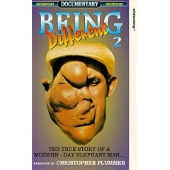 Being Different - 2 [VHS] [UK Import]