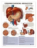Chart - Understanding Hepatitis