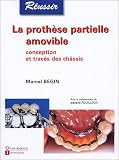 La proth�se partielle amovible : Conception et trac�s des ch�ssis