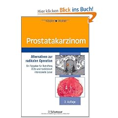 Prostatakarzinom: Alternativen zur radikalen Operation. Ein Ratgeber f�r Betroffene, �rzte und medizinisch interessierte Leser