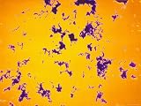 Streptococcus Mutans X1000 Photomic Photographic Poster Print, 32x24