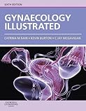Gynaecology illustrated