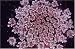 PINK Queen Anne's Lace Seeds-Very Rare!