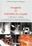 Imagerie et infertilit� du couple